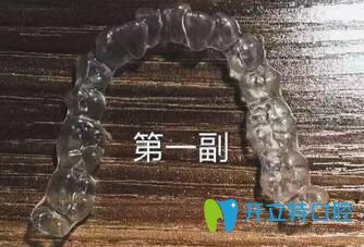 我在煙臺(tái)百仕口腔戴的頭一副隱形牙套