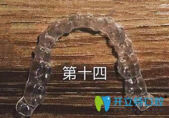 我在煙臺(tái)百仕口腔戴的時(shí)代天使隱形牙套