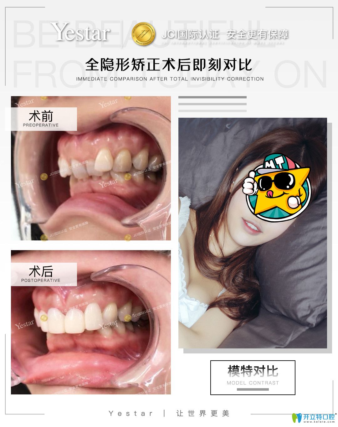 在寧波藝星口腔戴隱形牙套是什么感受，真實正畸經(jīng)驗分享