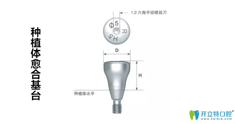 種牙前建議先弄清楚種植牙愈合基臺(tái)是什么以及它的作用