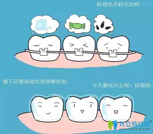 隱形矯正牙套更方便、舒適