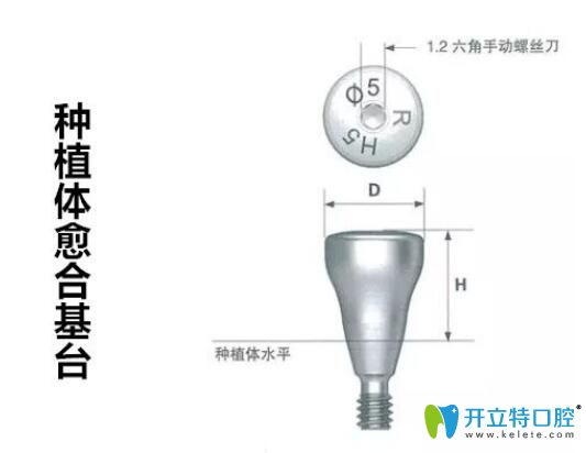 種植牙愈合帽有什么作用
