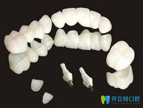 陶瓷牙怎么樣