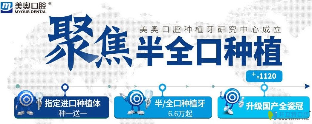 超劃算！杭州美奧口腔美國皓圣和法國安卓健都是種1送1吶