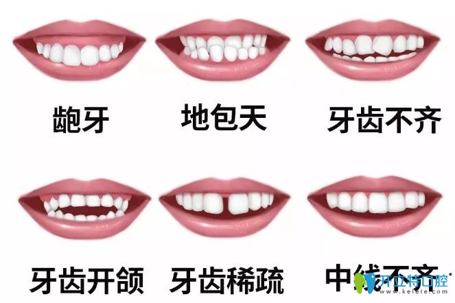 中秋不妨趁著維樂口腔牙齒矯正價格優(yōu)惠來做正畸