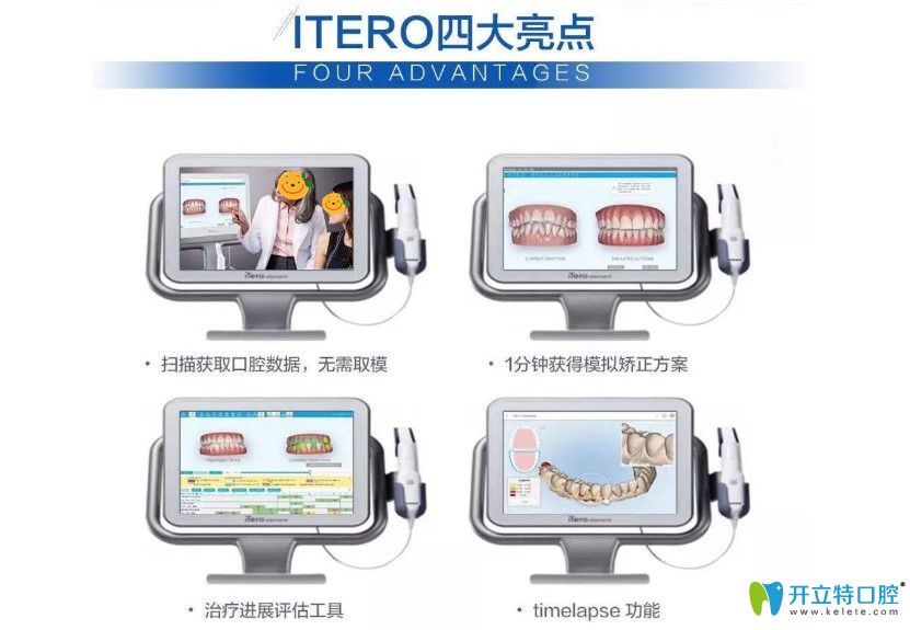 在維樂口腔可以免費(fèi)體驗iTero口掃