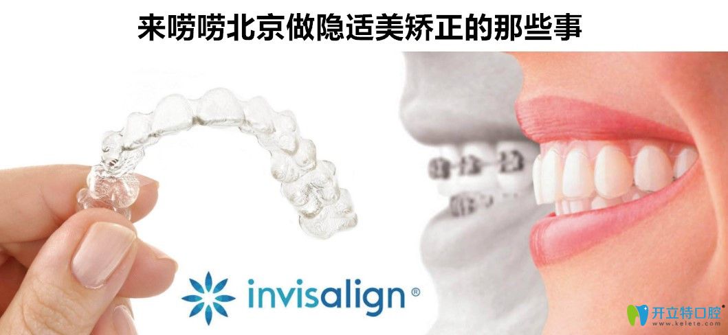 北京隱適美矯正哪家醫(yī)院比較好及北京隱適美牙套價格