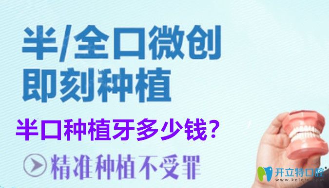 西安半口種植牙價(jià)格是多少？allon4半口即刻種植牙5萬(wàn)夠嗎？