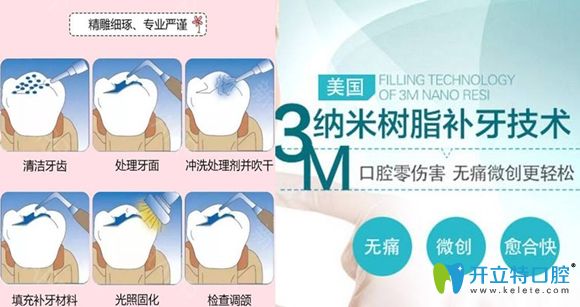 3M樹(shù)脂補(bǔ)牙優(yōu)勢(shì)圖