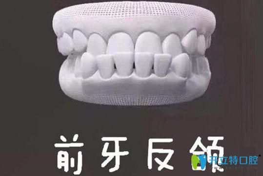 牙齒地包天能自我矯正嗎？牙齒反頜的矯正方法了解一下吧