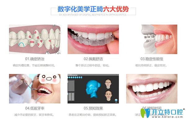 數(shù)字化美學(xué)正畸六大優(yōu)勢(shì)