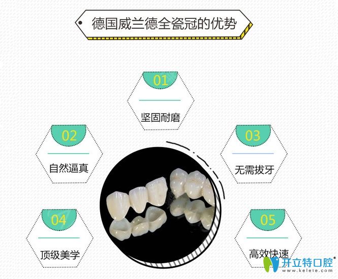 德國(guó)威蘭德全瓷牙優(yōu)點(diǎn)