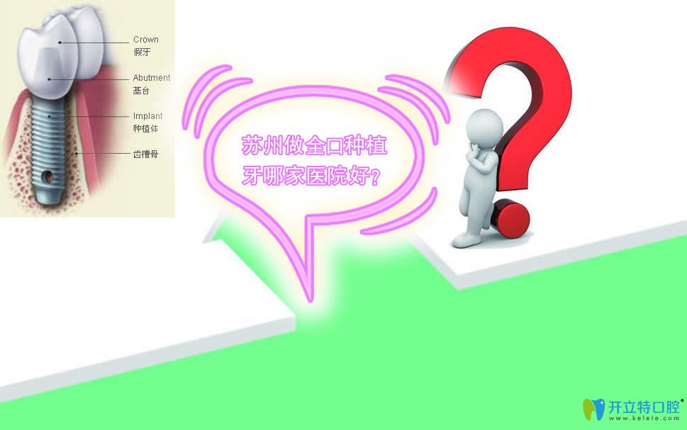 求問:蘇州做全口種植牙口碑好價格又適中的口腔醫(yī)院有哪些?