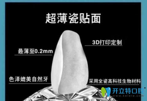 超薄瓷貼面