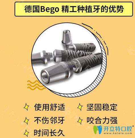 德國(guó)Bego種植體