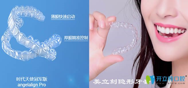 國產(chǎn)隱形矯正品牌中時(shí)代天使和美立刻牙套哪個(gè)好,區(qū)別在哪