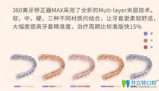 國產360美牙隱形牙套圖片