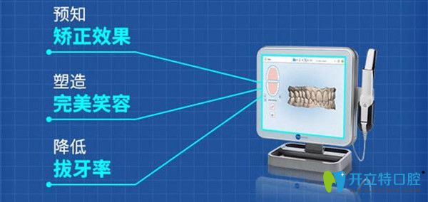 iTero數(shù)字化口掃儀