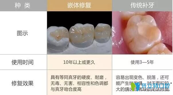 嵌體和補牙的區(qū)別