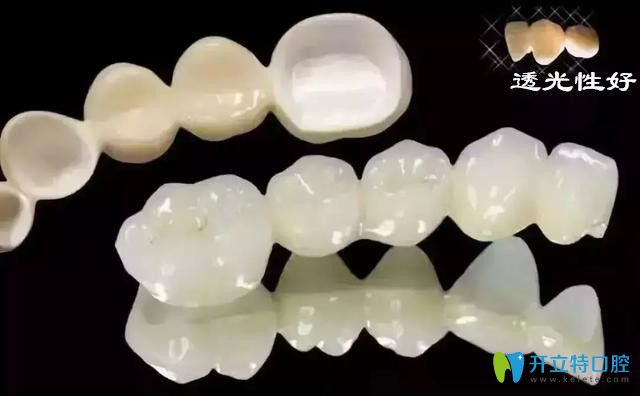 武漢做全瓷牙冠多少錢一顆?進口全瓷牙三大品牌價格也不同