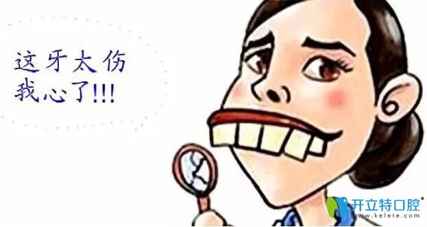 齙牙妹在鄭州卓越口腔做金屬自鎖托槽矯正后是這樣評價(jià)的