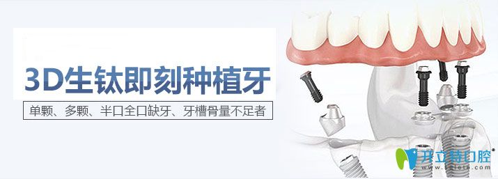 廣州陽(yáng)光樹口腔即刻種植牙圖示