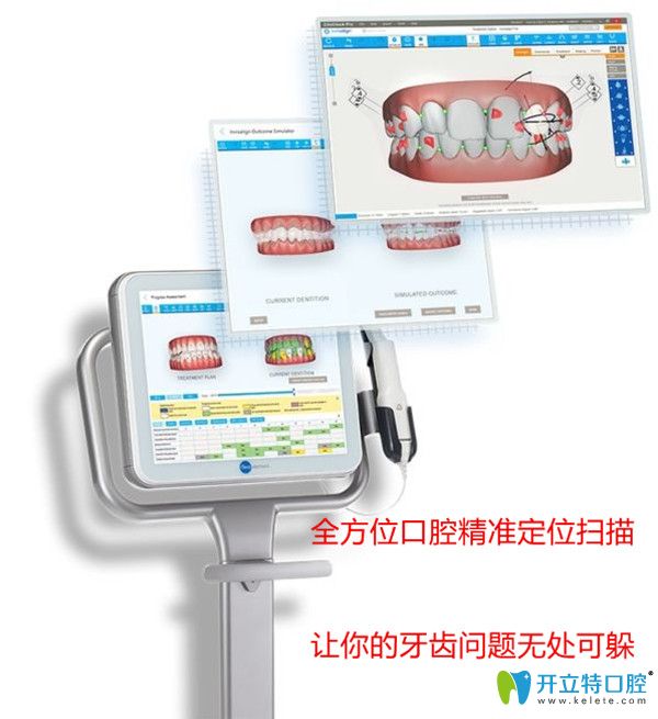 口掃儀3D成像