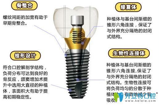 傅氏韓國登騰種植體