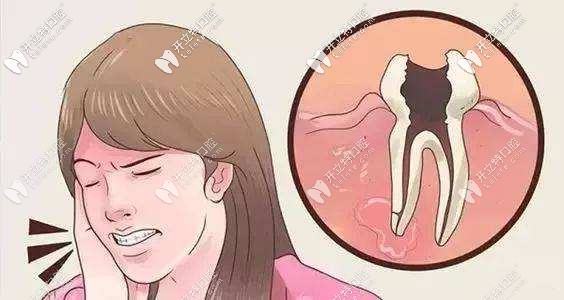 牙疼起來(lái)真要命呀