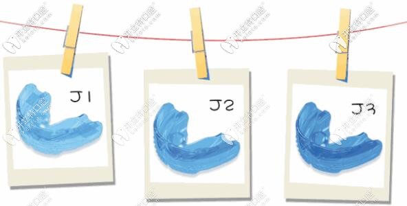 mrc矯治器系列
