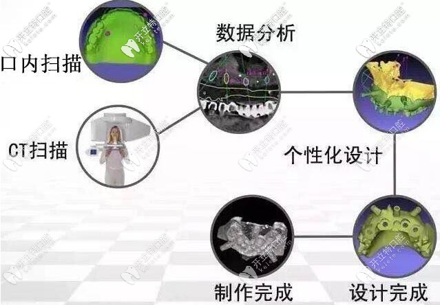 3D數(shù)字化導(dǎo)板種植牙不翻瓣