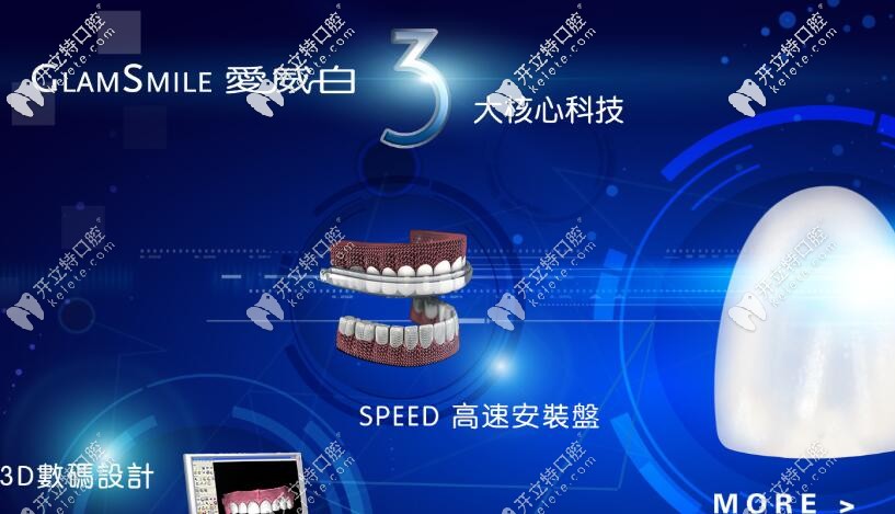 別問(wèn)多少錢了，先來(lái)科普下愛(ài)威白牙齒貼面的秘密