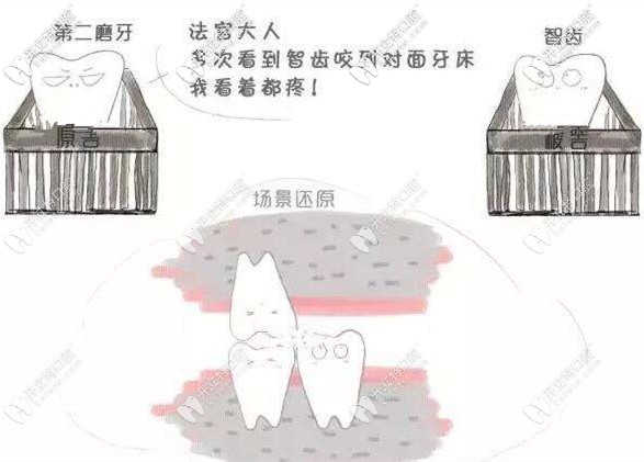 沒有咬合關(guān)系的智齒需要拔除