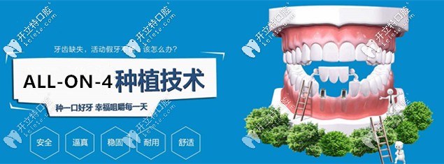 坐標(biāo)東莞，想做ALL-on-4即刻負(fù)重種植牙求推薦靠譜的醫(yī)院！