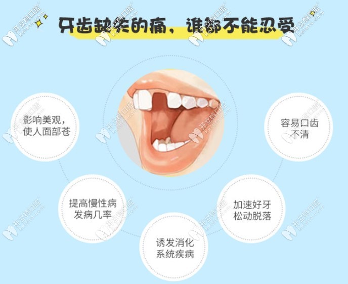 北京奧齒泰全口種植牙得多少錢