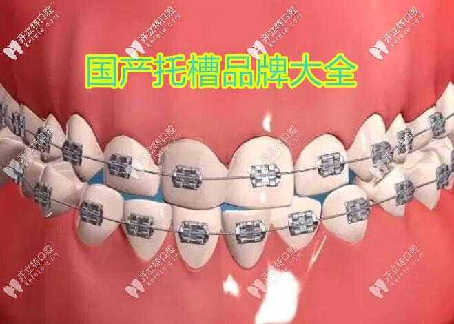國產(chǎn)托槽品牌大匯總,你知道價(jià)格貴的和便宜的區(qū)別在哪里嗎