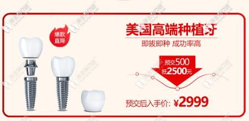 西安諾貝爾口腔門(mén)診部美國(guó)種植體價(jià)格