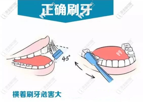 正確的刷牙方法能避免牙齒敏感