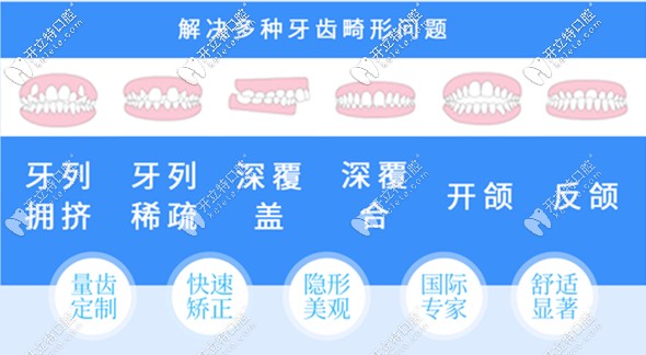 濰坊隱形牙齒矯正價格