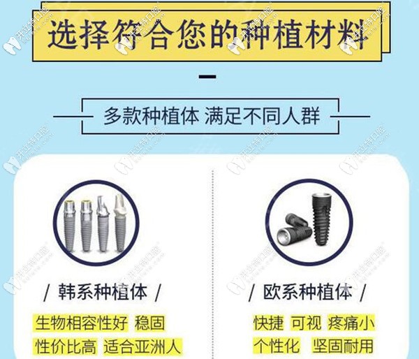 ?？诙c(diǎn)口腔韓系和歐系種植體