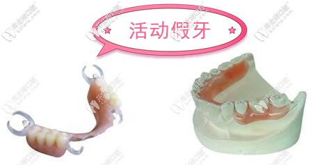 福州牙科鑲假牙收費(fèi)價目表
