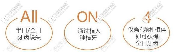 all-on-4種植技術(shù)