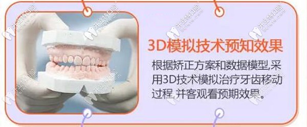 在?？诙c口腔做牙齒矯正前可先看效果