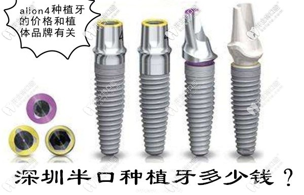 深圳allon4半口種植牙需要10萬(wàn)嗎