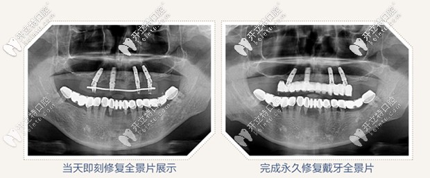 全景片圖示