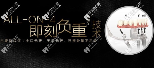 福州allon4即刻負重種植牙多少錢