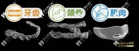 時(shí)代天使angelalign KiD型號(hào)