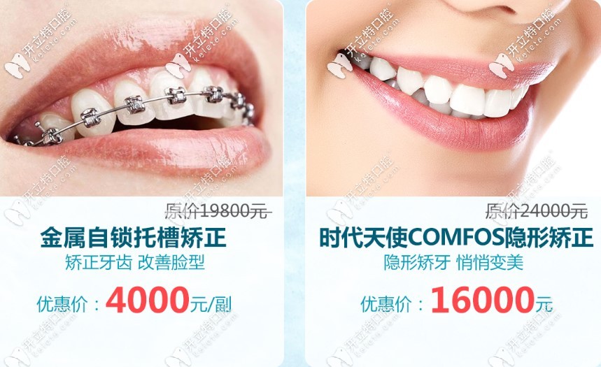 廣州市牙套價(jià)格表請收藏,金屬自鎖+隱形矯正的費(fèi)用值得一觀