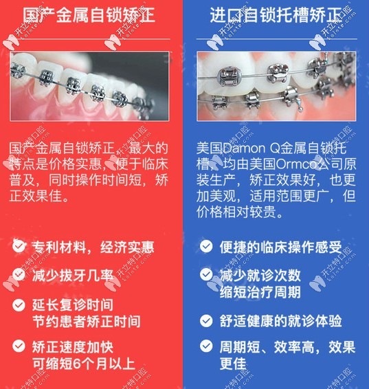 國產(chǎn)與進口金屬自鎖矯正區(qū)別