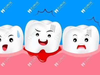牙周炎牙齦出血情況